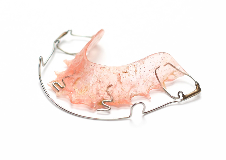 矯正完了・保定期間