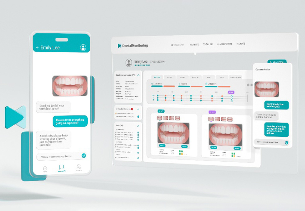 デンタルモニタリング画像2